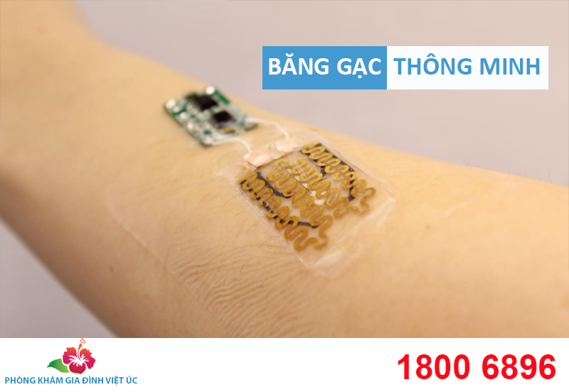 bang-gac-thong-minh
