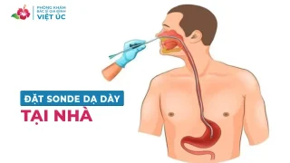 Dịch vụ đặt sonde dạ dày tại nhà