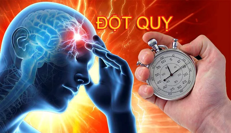 sơ cứu người bệnh đột quỵ