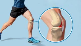 bị đau gối khi chạy bộ