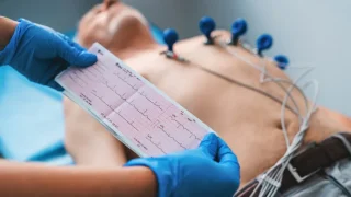 mắc cực điện tim