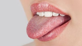 xuất hiện đốm đỏ ở lưỡi